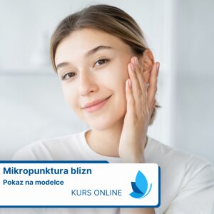 Mikropunktura Blizn – Pokaz Zabiegu na Modelce